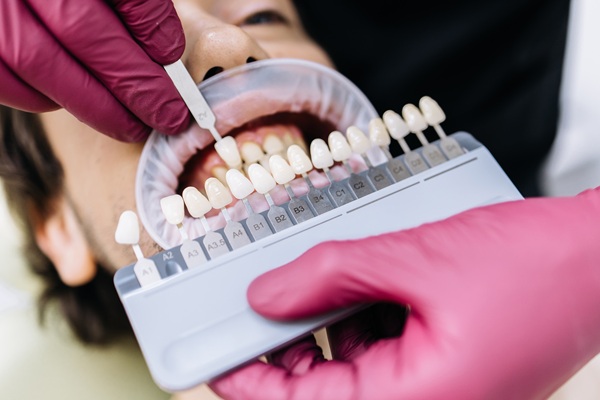 Ask A Cosmetic Dentist: Can I Whiten My Teeth Effectively At Home?