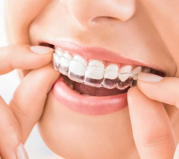 Oxnard Does Invisalign Really Work