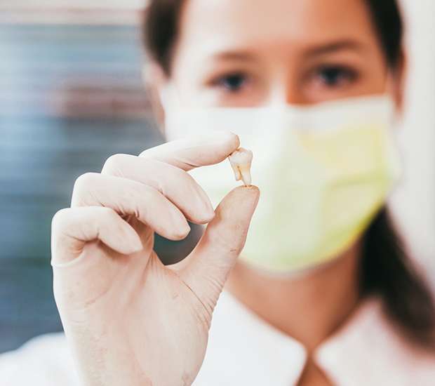 Oxnard Tooth Extraction